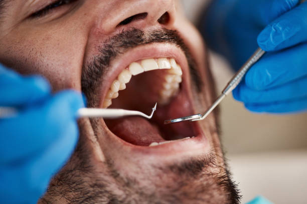 Trusted ME Emergency Dentist Experts